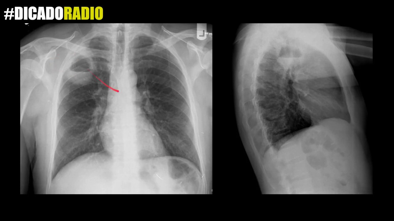 Cuantas radiografías se pueden hacer al año