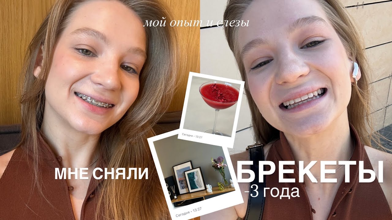 МНЕ СНЯЛИ БРЕКЕТЫ! | сложности, слезы и моя история 