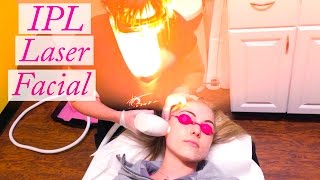 My IPL Photofacial Laser Experience & Results