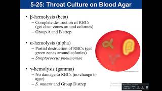 5-25, 5-26, 4-3: Throat cultures, CAMP test and Bile Esculin Agar