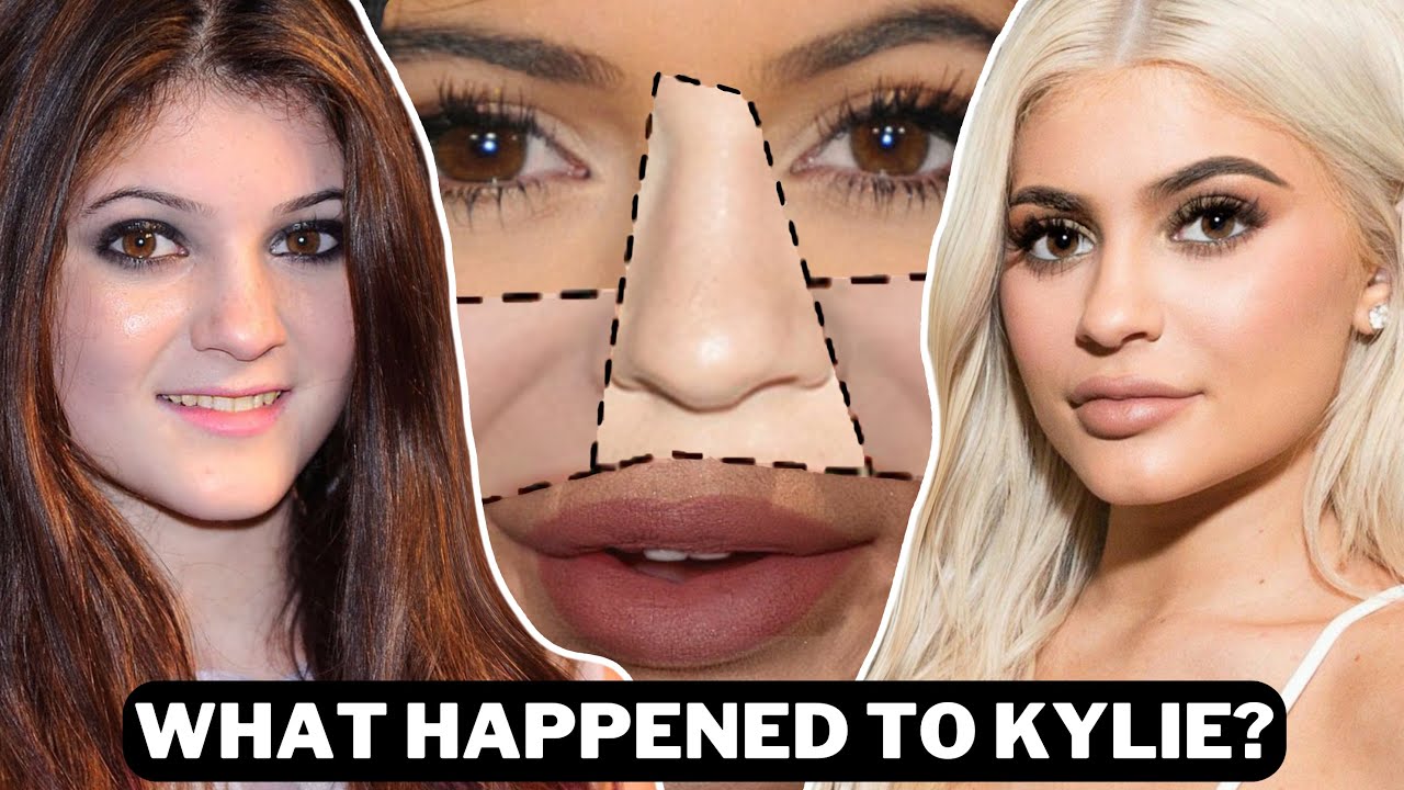 The Tragic Transformation Of Kylie Jenner (This Is So Strange) - Youtube