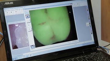 Workflow of ScanX Swift, Polaris Intraoral Camera and Spectra Caries Aid
