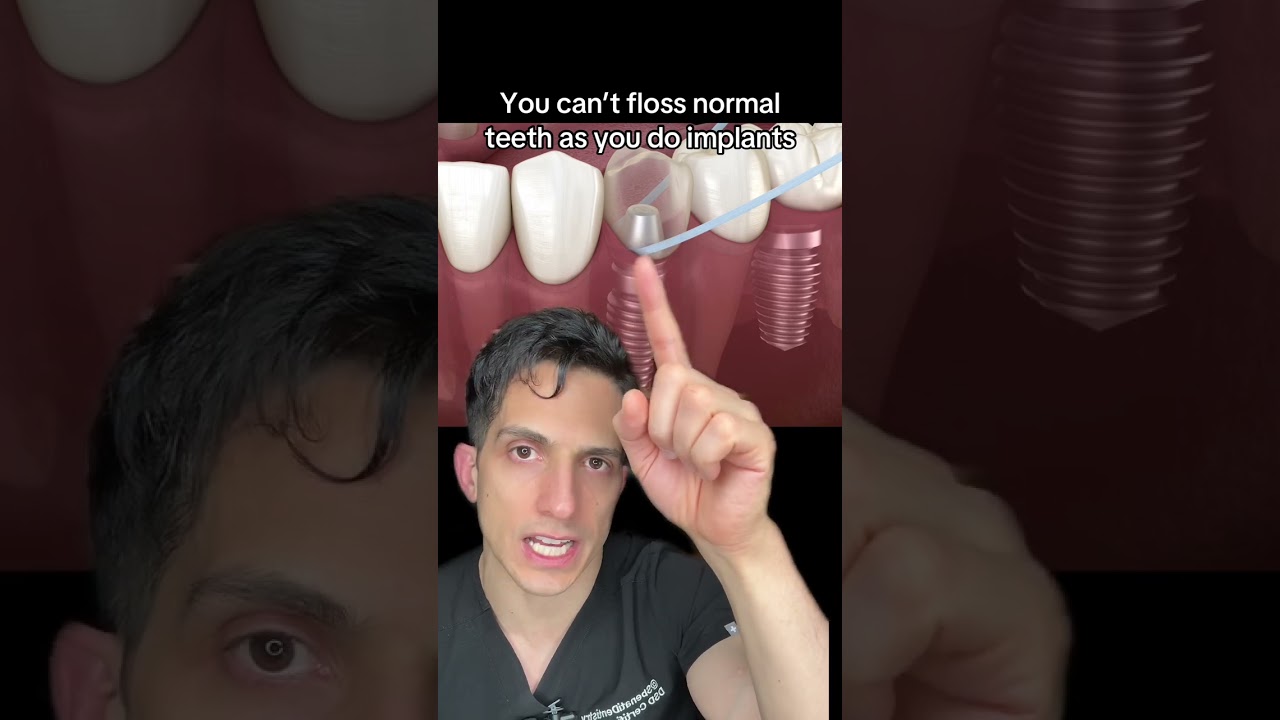 Be careful with flossing Implants