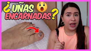 ¿Cómo SACAR una UÑA ENCARNADA HÁZLO como PROFESIONAL ✅ - Curso De Uñas 012