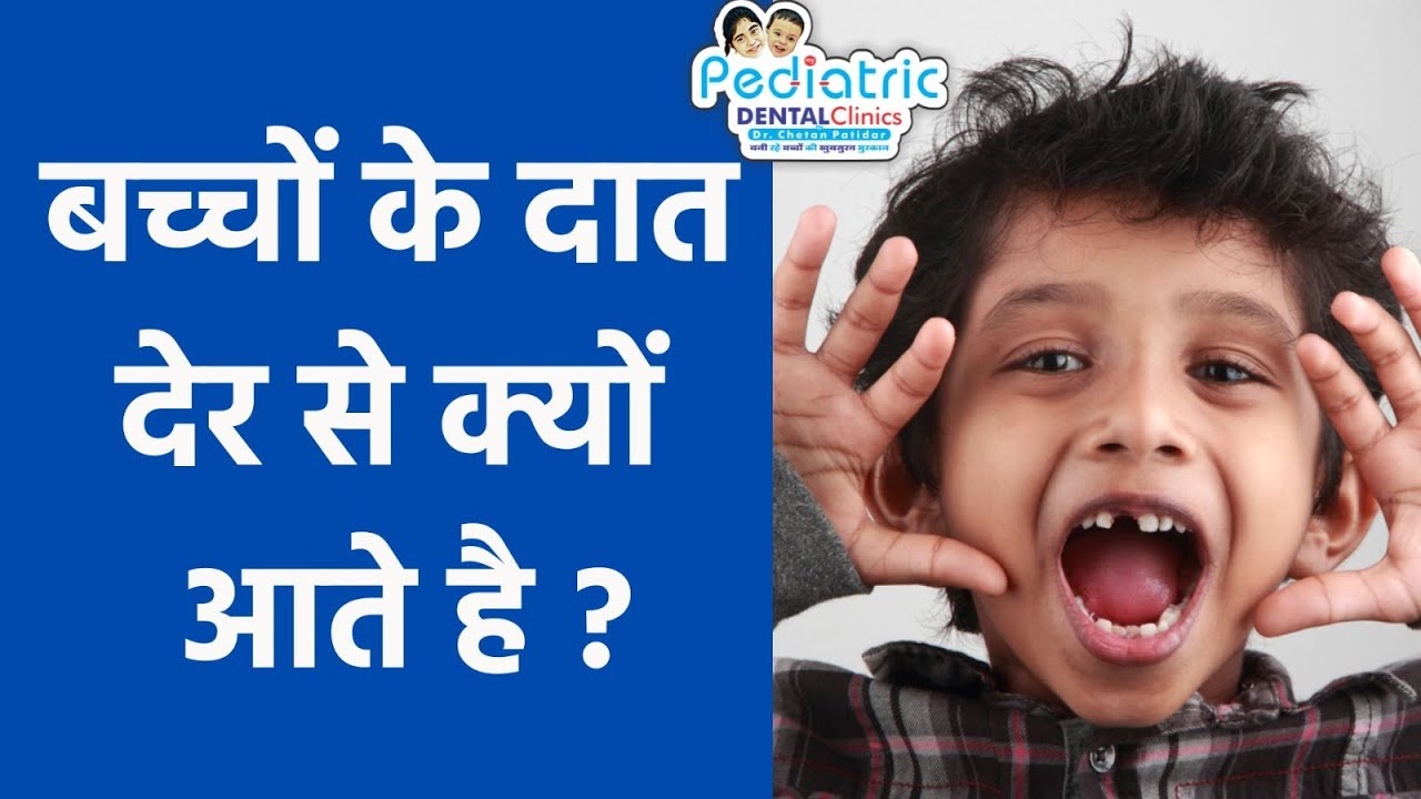 बच्चों को पहला दात कब आना चाहिए? | डॉक्टर को कब दिखाये? | Delayed Tooth Eruption | Child Dentist