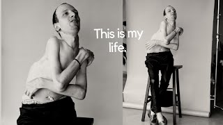 My Body is Locked into Place Permanently. Born Different Photoshoot