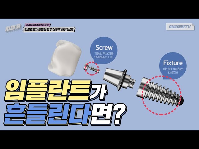 임플란트가 흔들려요 흔들림 어쩌죠? 치과의사가 알려주는 꿀팁 | 강남 아름드리치과