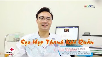 Sẹo hẹp thanh khí quản | Bác Sĩ Của Bạn || 2022
