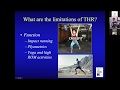 Dr. Edwin Su provided an update on hip resurfacing in 2020 via a zoom webinar