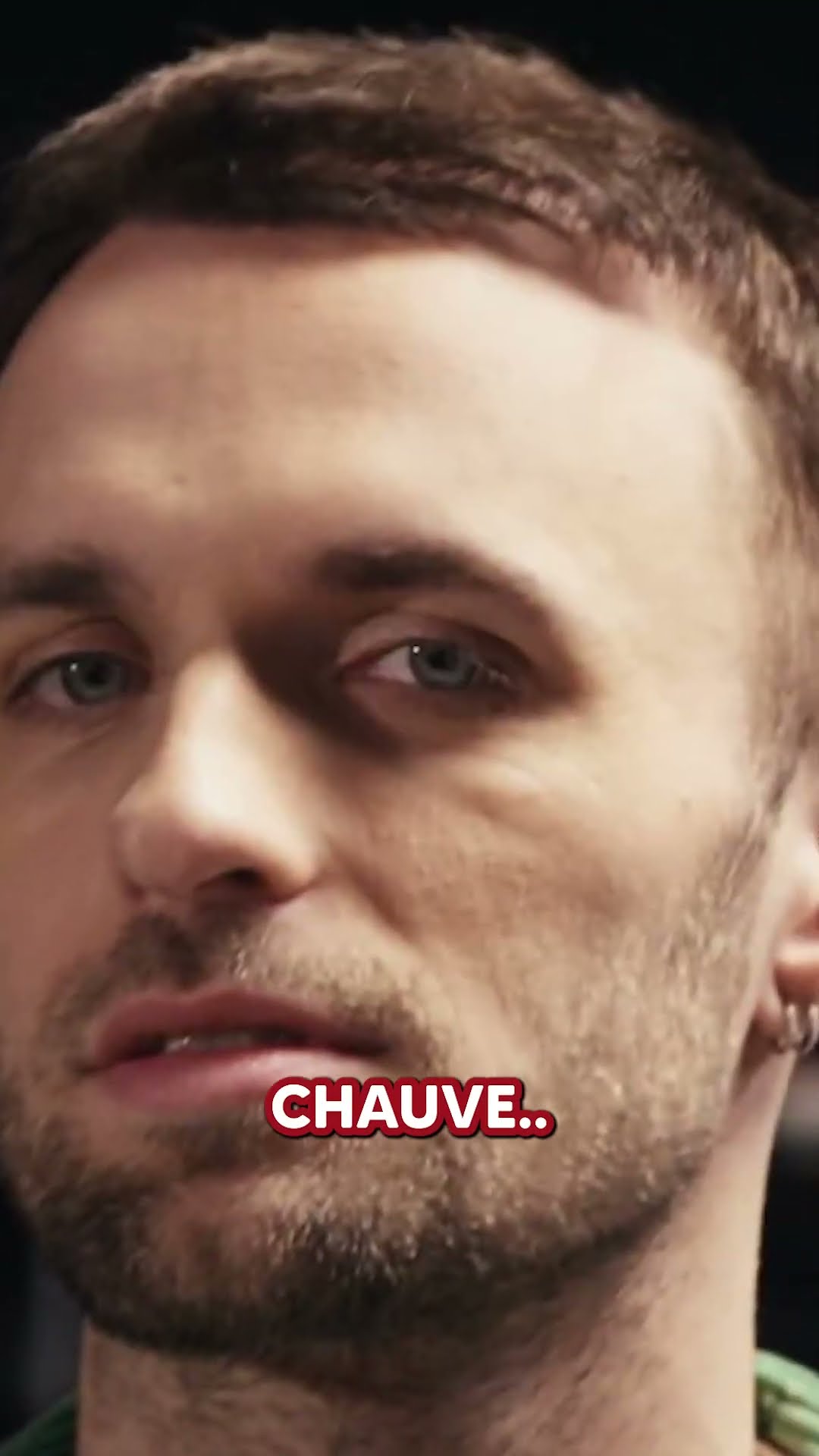 Squeezie se fait raser le crâne ?