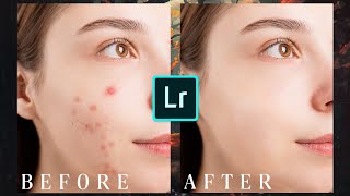 Remove Pimples in Lightroom Mobile 2022 | Face Retouching | Skin Smoothing screenshot 1