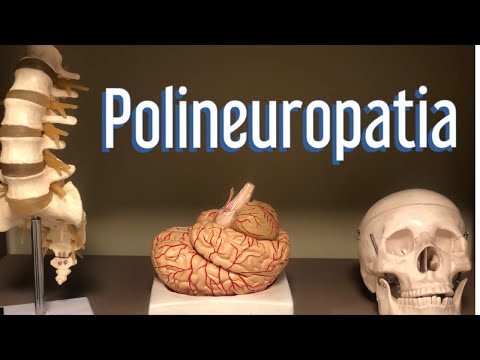 Vídeo: Em termos médicos, o que é uma polineurite?