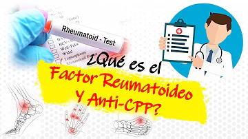 ¿Cuál es el factor reumatoide más alto?
