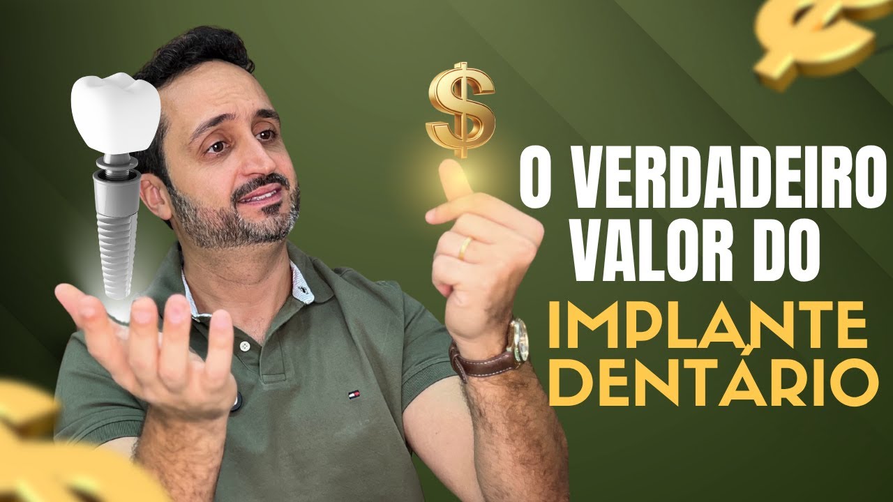 QUANTO CUSTA UM IMPLANTE DENTÁRIO? Tudo o que você precisa saber!