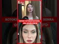 Düğününe 3 ay kala botoks yaptırdı! Hayatı cehenneme döndü! #shorts