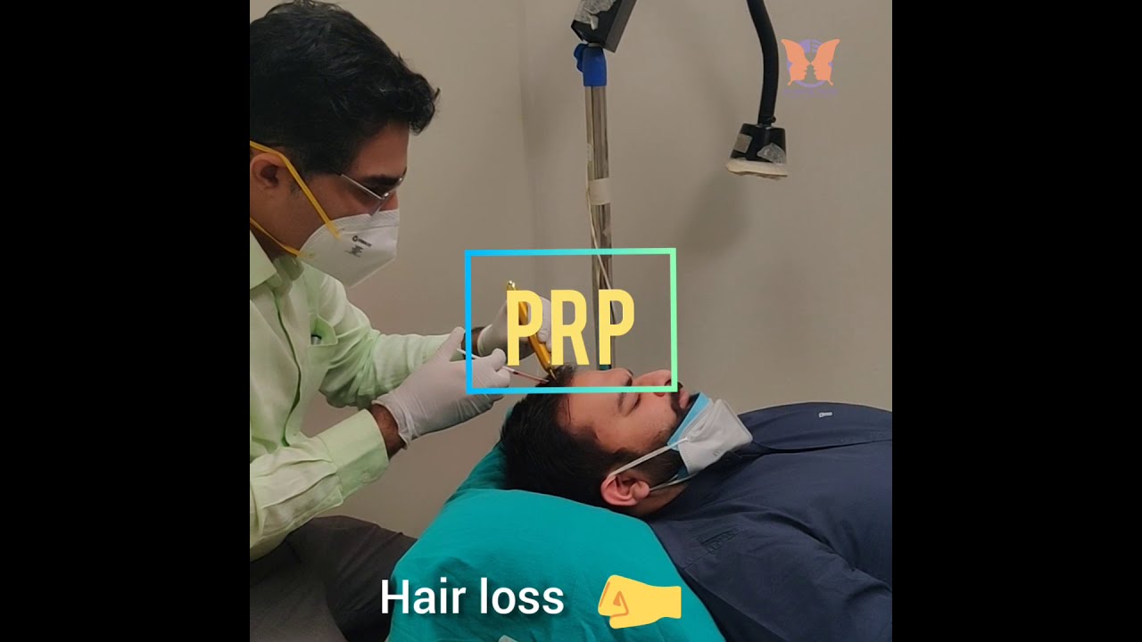 PRP for Hair loss done on a surgeon in Gurugram