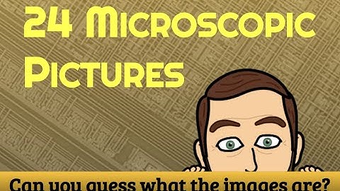 Can you guess what the Microscopic Images are?