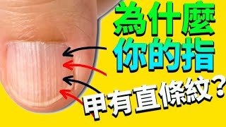 解析指甲上的垂直条纹：原因和自然疗法