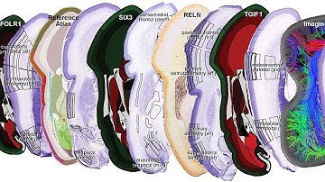 Fueling Discovery: BrainSpan Atlas of the Developing Human Brain