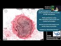 CCP-volumeEM: Connecting People, Tools, and Data Across the Volume EM Community | Martin Jones