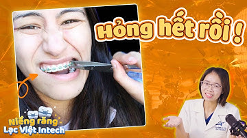 Có Nên Tự Tháo Mắc Cài Tại Nhà?| Reaction Video Hot| Lạc Việt Intech Niềng Răng