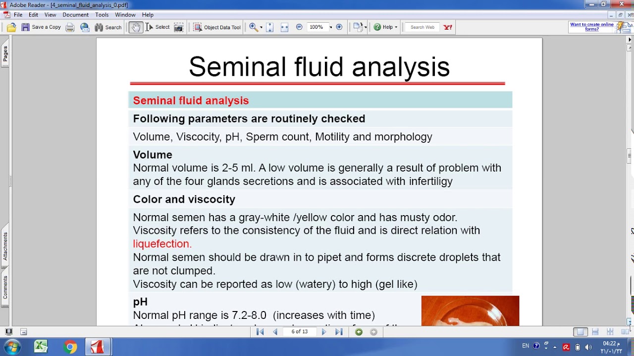Seminal Uid Analysis المحاضرة 4 seminal fluid analysis - YouTube