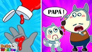 ¡Papá, Al bebé Wolfoo le duele la mano! Lección de seguridad infantil  Dibujos animados para niños