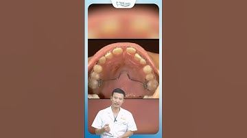 Nong Hàm Có Tác Dụng Gì ? | Bác Sĩ Yên