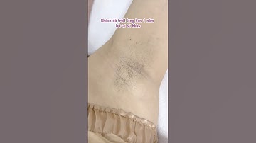 TẠI SAO ĐI TRIỆT LÔNG VĨNH VIỄN Ở SPA MÀ LÔNG VẪN MÃI KHÔNG HẾT #trietlongvinhvien #andu #laserdiode