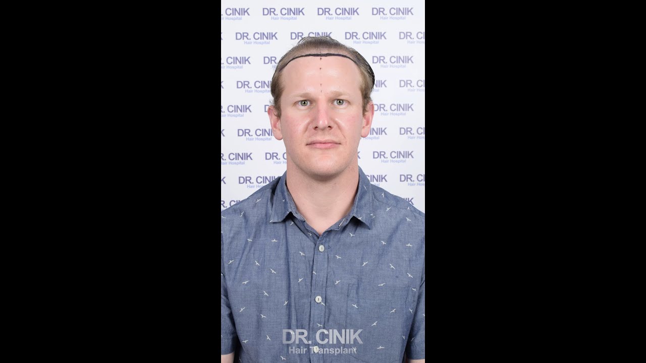 Embrace The New You | Dr. Cinik Hair Hospital