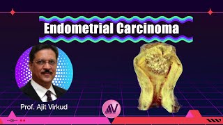 Endometrial Cancer Masterclass screenshot 1