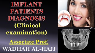 5-Diagnosis and treatment plan of implant patients(2)-Clinical examination. Wadhah implant lectures screenshot 4