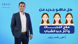 كل ماهو جديد عن علاج الندبات وآثار حب الشباب - دكتور| محمد وليد