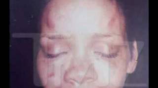 Beaten Rihanna - before and after