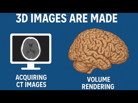 How CT Brain 3D Images Are Made | Volume Rendering Explained!!