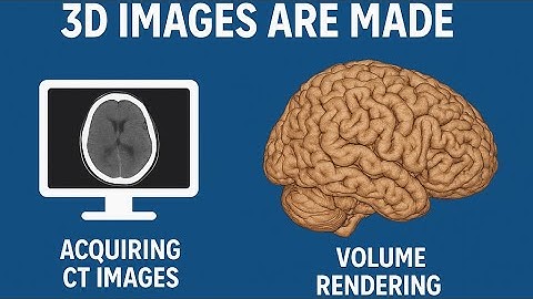 How CT Brain 3D Images Are Made | Volume Rendering Explained!!