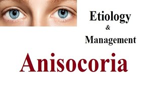 Anisocoria; Etiology, investigation and management
