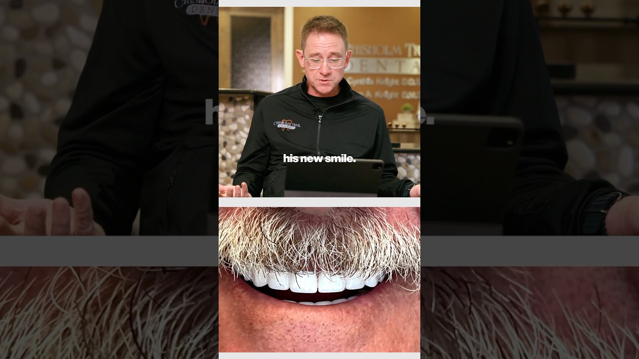 “I Wish I Could Do Them Everyday” Dentist Explains His Favorite Case 