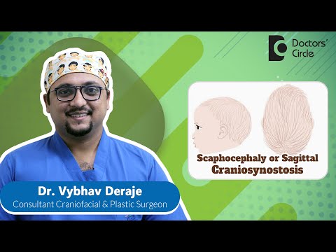 Long & Narrow Head In Baby|Scaphocephaly|Craniosynostosis #newborn -Dr.Vybhav Deraje|Doctors' Circle