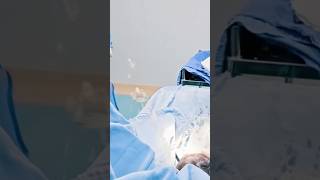 birth blog #baby #cutebaby #newbornbaby #ytshorts #cute #trending #birthvlog #twins