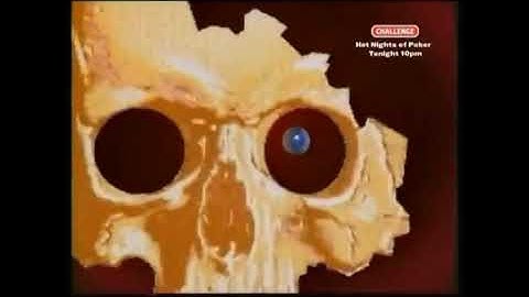 Ooh, Nasty! Every Death In Knightmare (A Supercut)