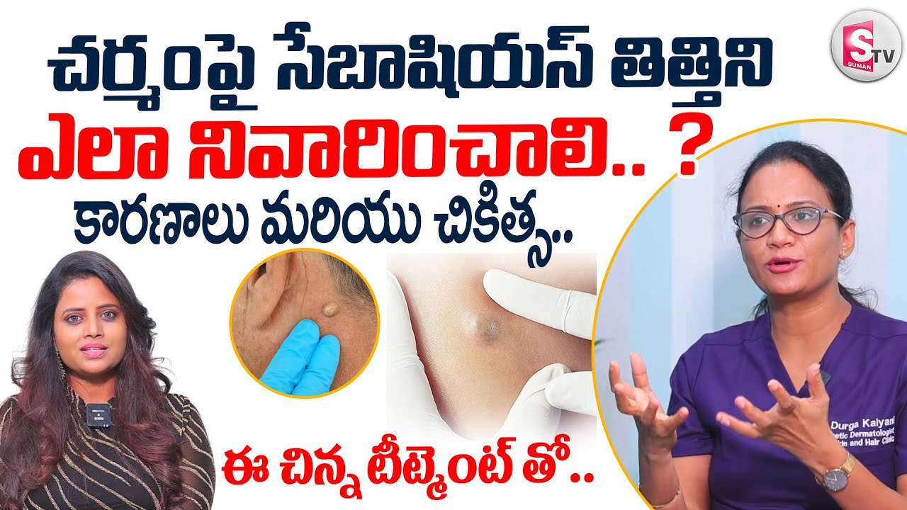 Dr Durga about Sebaceous Cyst on Skin | Causes and Treatment of Cysts on Skin |