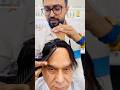 0.3mm Hair patch #wigs #wigsinstall #hairtransformation #hairloss #siliguri #kolkata #patch #patch