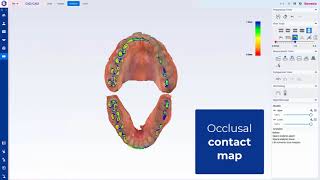 planmeca romexis 6 4 highlights 540p