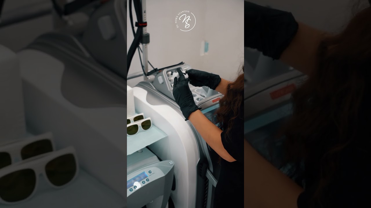 Laser hair removal by Clarity 2