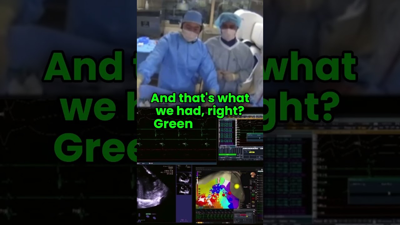 VT mapping with HD Grid catheter