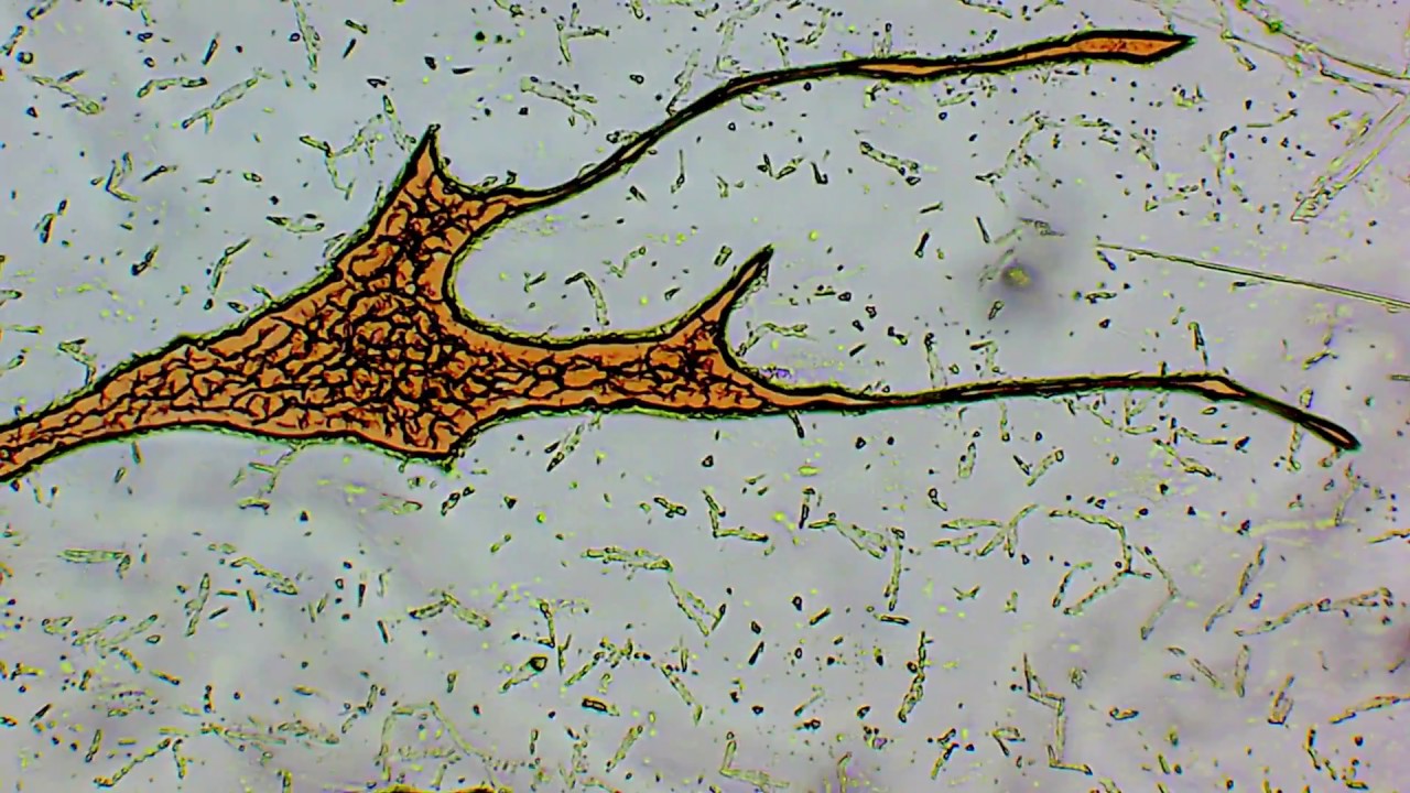 Это рекордное супер высокое разрешение записи камеры микроскопа 3840х2160 4K UHDTV (2160p)