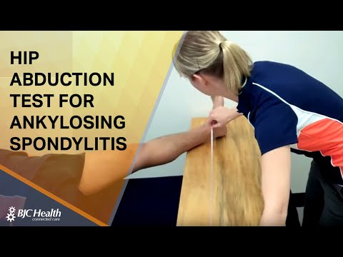 Hip Abduction Test for Ankylosing Spondylitis