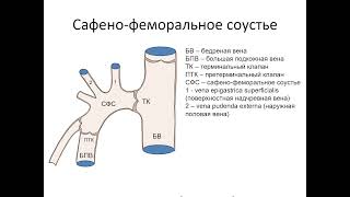 Сафено-феморальное соустье