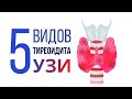 5 видов тиреоидитов. Как они выглядят на УЗИ? Тиреоидит Хашимота, Риделя и Де Курвена. УЗИ картина